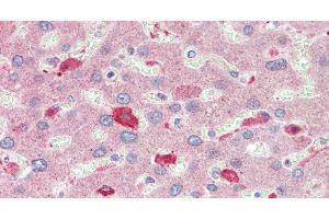 Immunohistochemistry of paraffin-embedded Liver tissue using BCAT1 Polyclonal Antibody at dilution of 1:100.