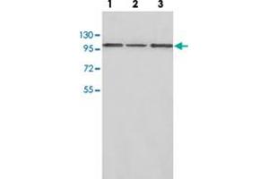 Western blot analysis of HepG2 (Lane 1), human fetal liver (Lane 2) and brain lysate (Lane 3) with CTNNA2 polyclonal antibody  at 1:500 dilution. (CTNNA2 抗体)