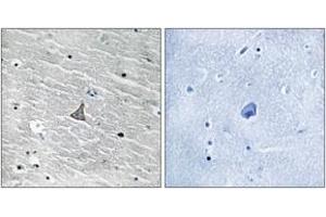 Immunohistochemistry analysis of paraffin-embedded human brain tissue, using VHL (Ab-68) Antibody. (VHL 抗体  (AA 34-83))