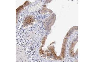 Immunohistochemical staining of human gallbladder with SASH3 polyclonal antibody  shows cytoplasmic positivity in glandular cells.