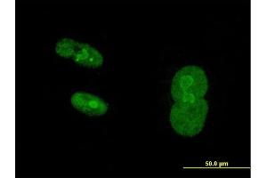 Immunofluorescence of purified MaxPab antibody to NR2C1 on Hs 181. (NR2C1 抗体  (AA 1-467))