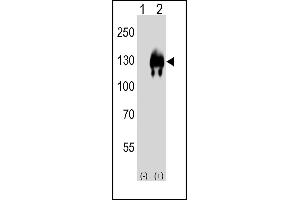 Western blot analysis of (arrow) using rabbit polyclonal EN Antibody (Center) (ABIN650746 and ABIN2839471). (ENPP2 抗体  (AA 377-406))