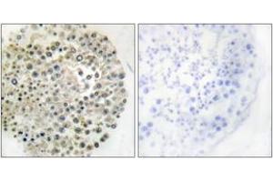 Immunohistochemistry analysis of paraffin-embedded human testis, using TRIM16 Antibody. (TRIM16 抗体  (AA 31-80))