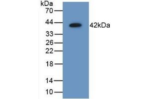 Detection of Recombinant AIMP1, Mouse using Polyclonal Antibody to Aminoacyl tRNA Synthetase Complex Interacting Multifunctional Protein 1 (AIMP1) (AIMP1 抗体  (AA 2-310))