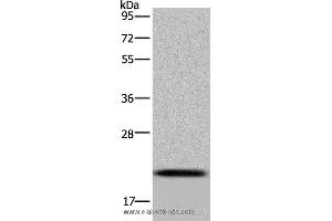 Western blot analysis of Raji cell, using NDUFAF4 Polyclonal Antibody at dilution of 1:300 (NDUFAF4 抗体)