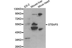 Western blot analysis of extracts of various cell lines, using STEAP3 antibody. (STEAP3 抗体  (AA 1-180))
