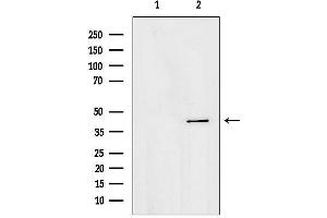 anti-1-Acylglycerol-3-Phosphate O-Acyltransferase 4 (AGPAT4) (Internal Region) antibody