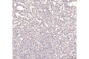 IHC analysis of ANGPT2 using anti-ANGPT2 antibody (ABIN3043725). (Angiopoietin 2 抗体  (AA 19-348))
