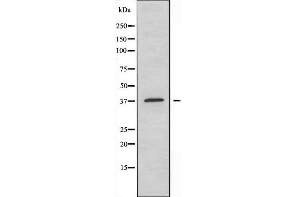 Annexin a10 antibody  (N-Term)