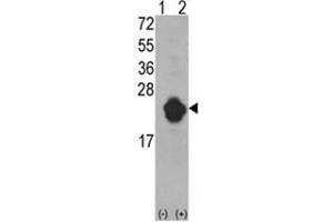 Western Blotting (WB) image for anti-Interleukin 1 Receptor Antagonist (IL1RN) (Middle Region) antibody (ABIN453130)