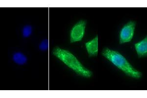 Immunofluorescence (IF) image for anti-Keratin 10 (KRT10) (AA 153-456) antibody (ABIN7433948)