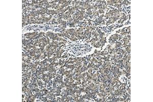 IHC analysis of SORBS3 using anti-SORBS3 antibody (ABIN7603121).