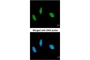 ICC/IF Image Immunofluorescence analysis of paraformaldehyde-fixed HeLa, using RBM15, antibody at 1:200 dilution. (RBM15 抗体)