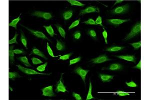 Immunofluorescence of monoclonal antibody to SMAD7 on HeLa cell. (SMAD7 抗体  (AA 160-260))