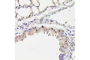 Immunohistochemistry of paraffin-embedded mouse lung using CDC23 antibody (ABIN7266248) at dilution of 1:100 (40x lens). (CDC23 抗体  (AA 50-150))