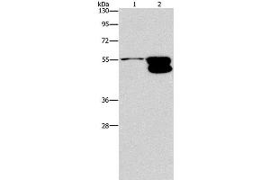 Western Blot analysis of NIH/3T3 cell and Mouse brain tissue using CRHR2 Polyclonal Antibody at dilution of 1:650 (CRHR2 抗体)