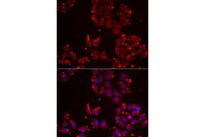 Immunofluorescence analysis of U2OS cells using MSRA antibody. (MSRA 抗体)