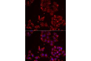 Immunofluorescence analysis of U2OS cells using MSRA antibody. (MSRA 抗体)