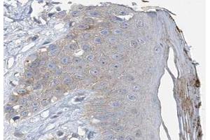 Immunohistochemistry (IHC) image for anti-Vasodilator-Stimulated phosphoprotein (VASP) (pSer157) antibody (ABIN6256156)