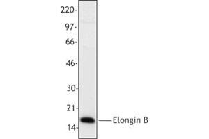 Image no. 1 for anti-Transcription Elongation Factor B (SIII), Polypeptide 2 (18kDa, Elongin B) (TCEB2) antibody (ABIN205406) (TCEB2 抗体)