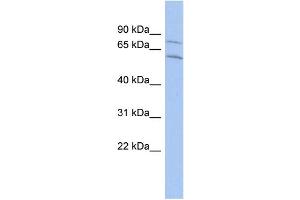 WB Suggested Anti-CNOT2 Antibody Titration:  0. (CNOT2 抗体  (Middle Region))