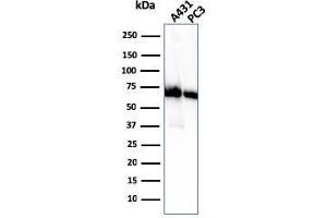 Western Blot Analysis of A431 and PC-3 cell lysate using CD73 Mouse Monoclonal Antibody (NT5E/2505). (CD73 抗体)