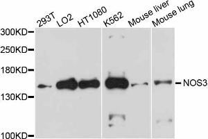 Western blot analysis of extracts of various cell lines, using NOS3 antibody (ABIN1873922) at 1:1000 dilution. (ENOS 抗体)