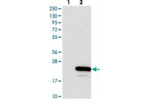 Western blot analysis of Lane 1: Negative control (vector only transfected HEK293T lysate), Lane 2: Over-expression Lysate (Co-expressed with a C-terminal myc-DDK tag (~3. (AVPI1 抗体)