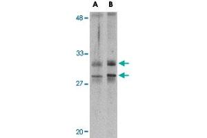 Western blot analysis of METTL7A in MCF-7 cell lysate with METTL7A polyclonal antibody  at 2 ug/mL . (METTL7A 抗体  (Internal Region))