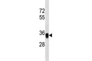 Western Blotting (WB) image for anti-Epithelial Cell Adhesion Molecule (EPCAM) (AA 200-229) antibody (ABIN3030857)