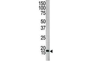 Western Blotting (WB) image for anti-Small Ubiquitin Related Modifier 4 (SUMO4) antibody (ABIN3032653)