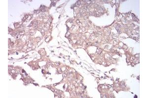 Immunohistochemistry (IHC) image for anti-RAB13, Member RAS Oncogene Family (RAB13) (AA 66-200) antibody (ABIN5542350)