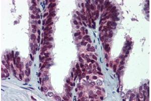 Human Prostate: Formalin-Fixed, Paraffin-Embedded (FFPE) (MDM2 抗体  (pSer395))