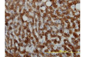 Immunoperoxidase of monoclonal antibody to KRT18 on formalin-fixed paraffin-embedded human liver tissue. (Cytokeratin 18 抗体  (AA 1-430))