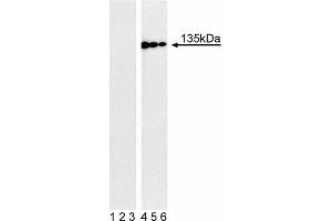 Western blot analysis of Tyk2 (pY1054/pY1055) in human Burkitt’s lymphoma. (TYK2 抗体  (pTyr1054))