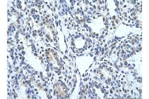 Rabbit Anti-KRT17 Antibody       Paraffin Embedded Tissue:  Human alveolar cell   Cellular Data:  Epithelial cells of renal tubule  Antibody Concentration:   4. (KRT17 抗体  (C-Term))