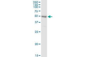 Immunoprecipitation of SHPK transfected lysate using anti-SHPK MaxPab rabbit polyclonal antibody and Protein A Magnetic Bead , and immunoblotted with SHPK purified MaxPab mouse polyclonal antibody (B01P) . (SHPK 抗体  (AA 1-478))