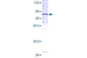 Image no. 1 for Acyl-CoA Dehydrogenase, Long Chain (ACADL) (AA 1-430) protein (GST tag) (ABIN1305584) (ACADL Protein (AA 1-430) (GST tag))