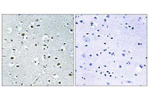 Immunohistochemistry analysis of paraffin-embedded human brain tissue using PPRC1 antibody. (PPRC1 抗体  (C-Term))