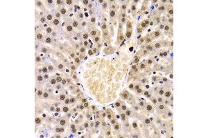 Immunohistochemistry (IHC) image for anti-Proline-, Glutamic Acid- and Leucine-Rich Protein 1 (PELP1) (AA 1021-1180) antibody (ABIN3023502)
