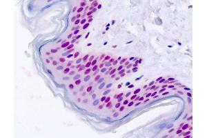 Human, Skin: Formalin-Fixed Paraffin-Embedded (FFPE) (FOXD1 抗体  (AA 1-30))