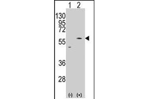 Western blot analysis of PMAT (SLC29A4) (arrow) using rabbit SLC29A4 polyclonal antibody . (SLC29A4 抗体  (AA 459-489))
