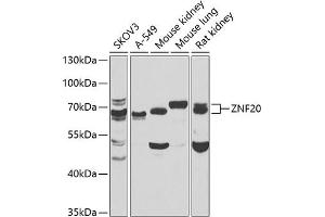 Western blot analysis of extracts of various cell lines, using ZNF20 antibody  at 1:1000 dilution. (ZNF20 抗体  (AA 1-200))