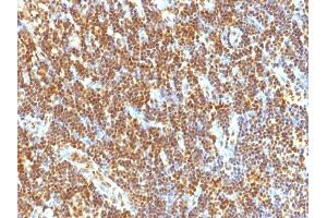 Immunohistochemistry (IHC) image for anti-Small Ubiquitin Related Modifier 2 (SUMO2) antibody (ABIN6940603)