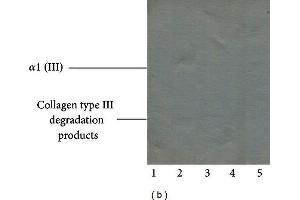 Western Blotting (WB) image for anti-Collagen, Type III (COL3) antibody (ABIN5596830)