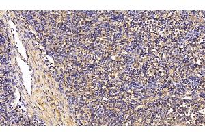 Detection of TGFb1 in Porcine Lymph node Tissue using Polyclonal Antibody to Transforming Growth Factor Beta 1 (TGFb1) (TGFB1 抗体  (AA 279-390))