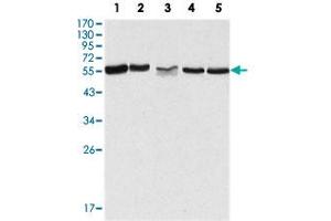 Western blot analysis using PAK2 monoclonal antibody, clone 3B5  against HeLa (1), Jurkat (2), A-549 (3), HEK293 (4) and K-562 (5) cell lysate.