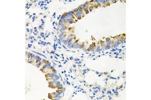 Immunohistochemistry of paraffin-embedded mouse lung using IRAK2 antibody. (IRAK2 抗体)
