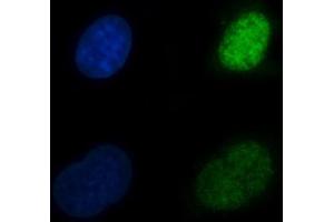 IF analysis of CBR1 using anti-CBR1 antibody (ABIN7600015). (CBR1 抗体  (AA 14-262))