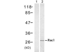 Western blot analysis of extract from A431 cell untreated or treated with EGF (200ng/ml, 5min), using Rac1 (Ab-71) antibody (E021201). (RAC1 抗体)